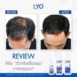 Lyo Shampoo Anti – Hair Loss