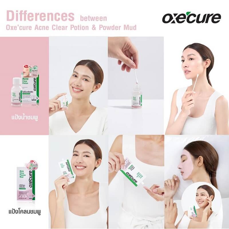 Oxe Cure Acne Clear Potion