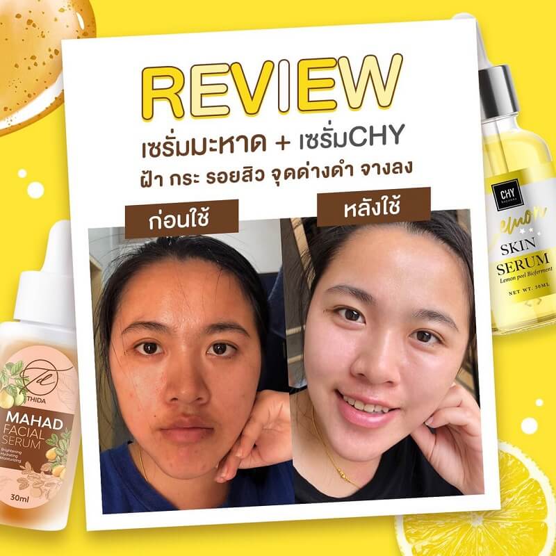 CHY Hoyonna Lemon Skin Serum