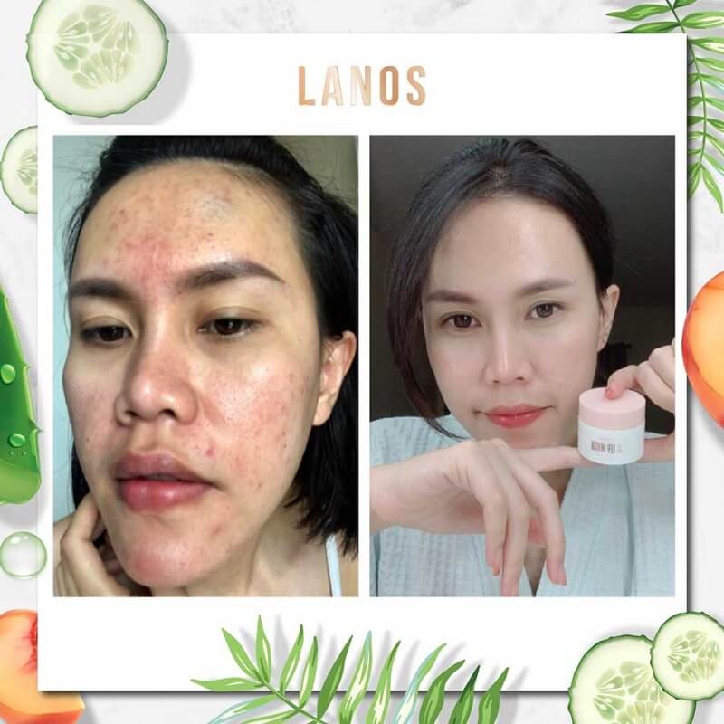 Lanos Jelly Mask Up