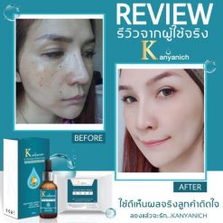 Kanyanich K Ultimate Whitening Serum