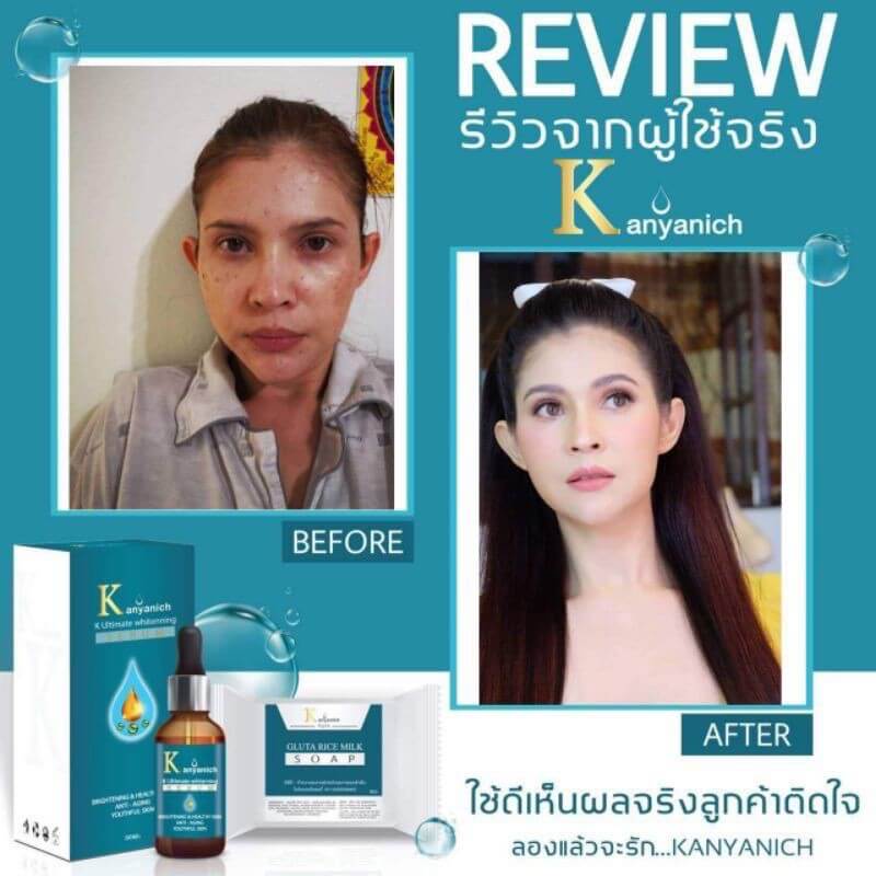 Kanyanich K Ultimate Whitening Serum