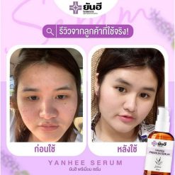 Yanhee Premium Serum
