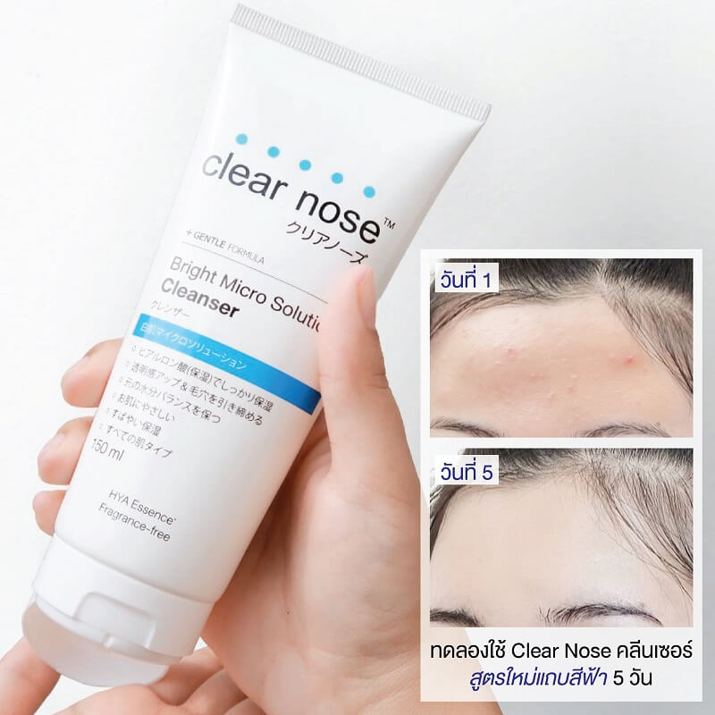 Clear Nose Bright Micro Solution Cleanser