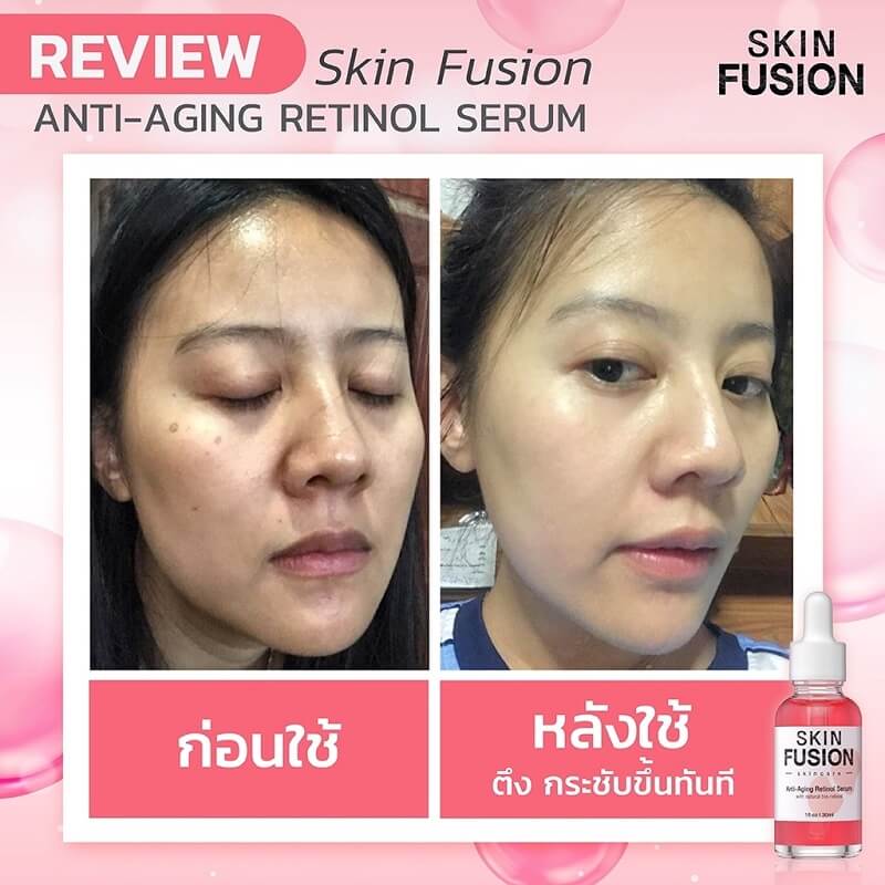 Skin Fusion Anti-Aging Retinol Serum