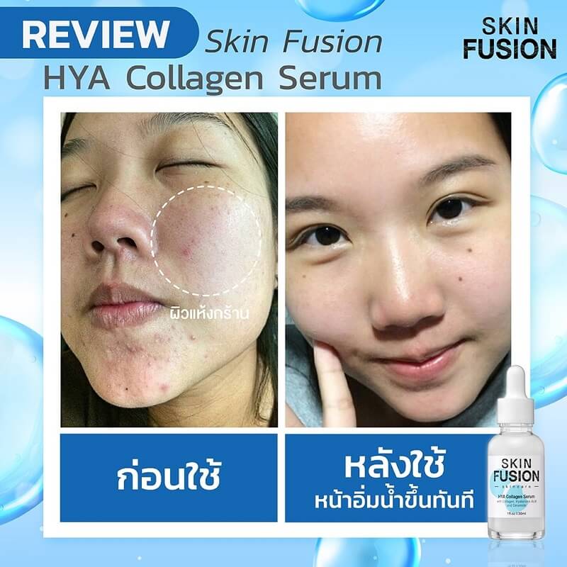 Skin Fusion Hya Collagen Serum