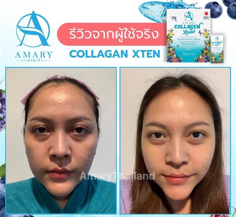 Amary Collagen Xtend