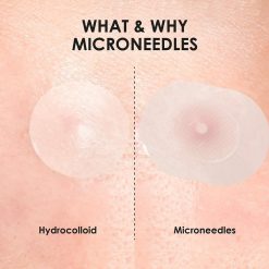 Oxe Cure Acne Clear Micro Patch
