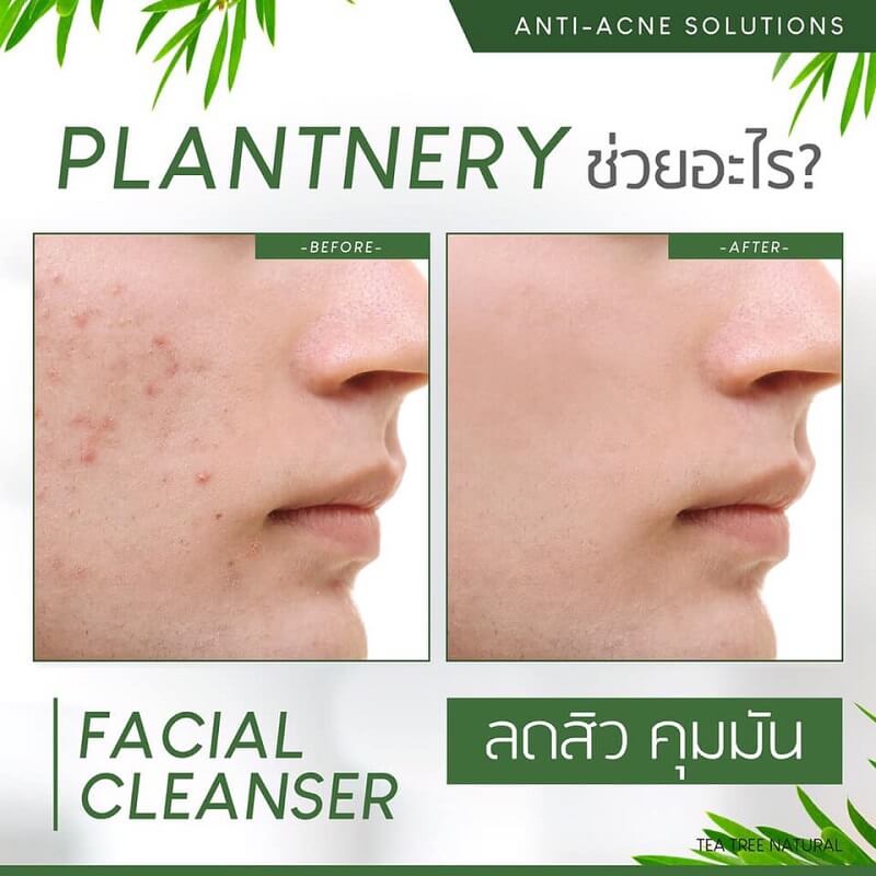 Plantnery Tea Tree Facial Cleanser