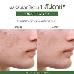 Plantnery Tea Tree First Toner