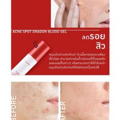 Baby Bright Acne Spot Dragon Blood Gel