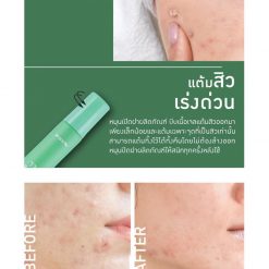 Baby Bright Clear Acne Gel