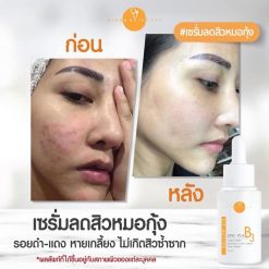 Vikka Skincare Vit-active B3