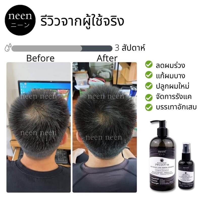 neen Black Pearl Anti Hair Loss Serum Shampoo