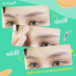 Dr.Pong 101 Acne Clear Concealer