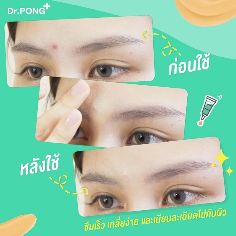 Dr.Pong 101 Acne Clear Concealer