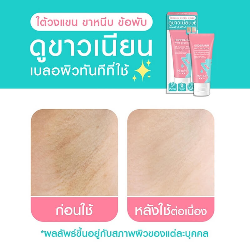 MizuMi Underarm White Booster