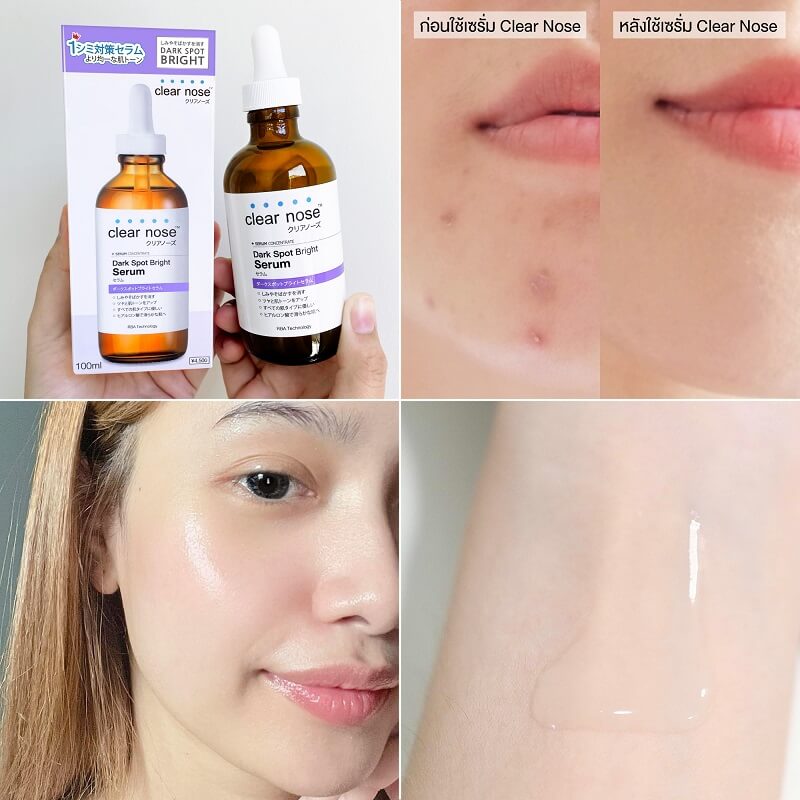 Clear Nose Dark Spot Bright Serum