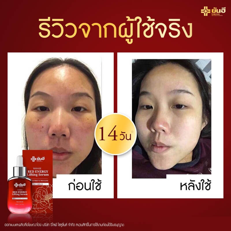 Yanhee Red Energy Lifting Serum