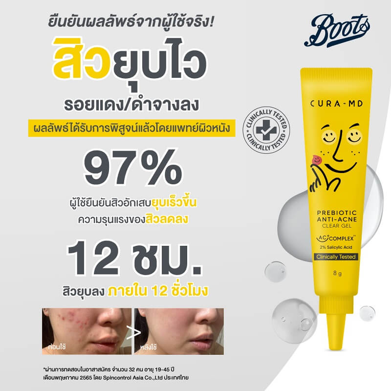 Cura-MD Prebiotic Anti-Acne Clear Gel