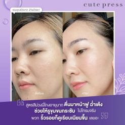 Cute Press Intensive Renewal Booster Serum
