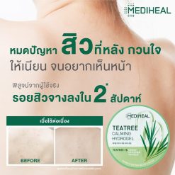 Mediheal Tea Tree Calming Hydrogel