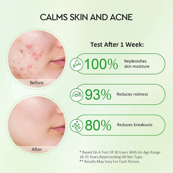 Glad2Glow Centella Allantoin Soothing Gel Moisturizer - Image 5
