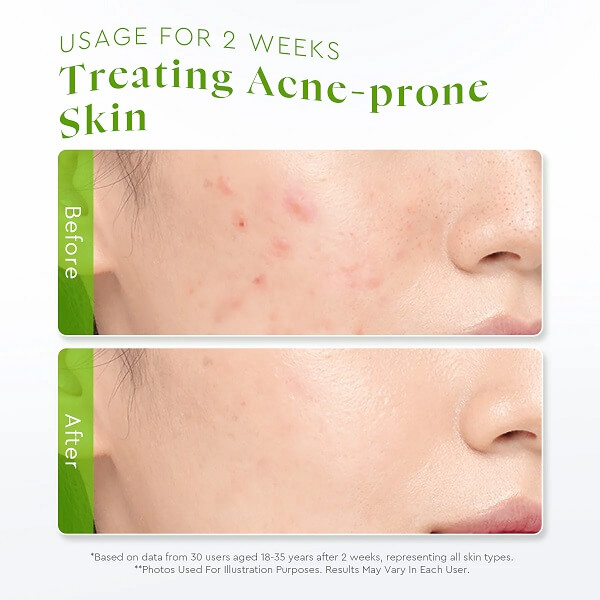 Glad2Glow Centella Allantoin Soothing Gel Moisturizer - Image 8