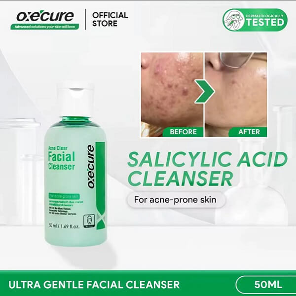 Oxe Cure Acne Clear Facial Cleanser - Image 11
