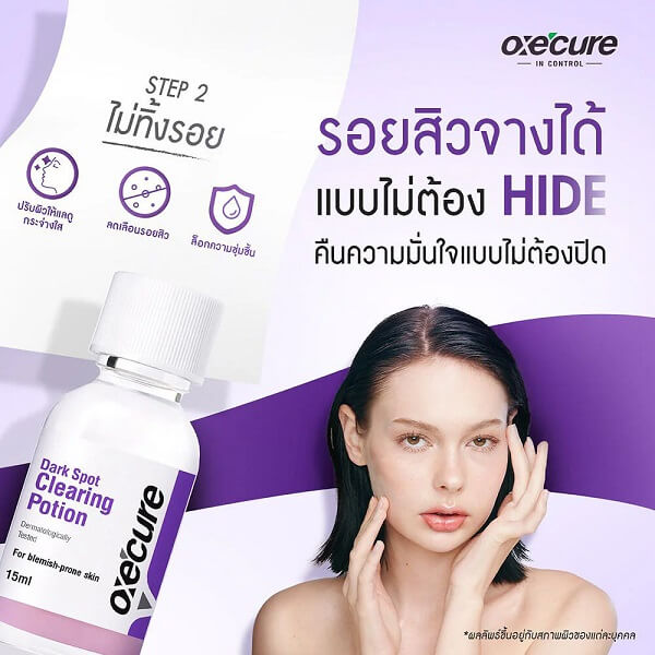 Oxe Cure Dark Spot Clearing Potion