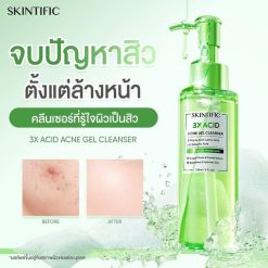 Skintific 3X Acid Acne Gel Cleanser