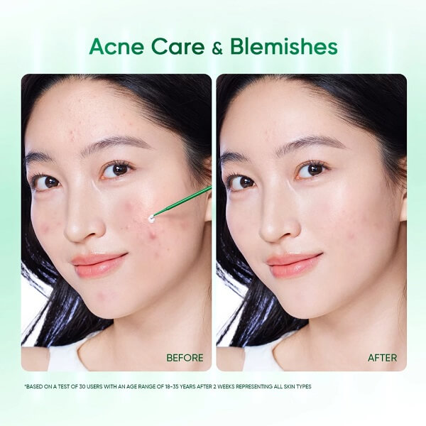 Skintific Acne Drying Lotion - Image 10
