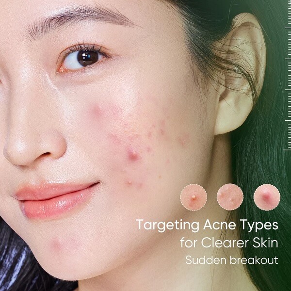Skintific Acne Drying Lotion - Image 11