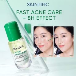 Skintific Acne Drying Lotion