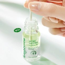 Glad2Glow Acne Drying Lotion