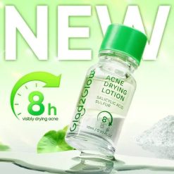 Glad2Glow Acne Drying Lotion