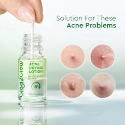 Glad2Glow Acne Drying Lotion