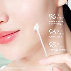 Glad2Glow Acne Drying Lotion