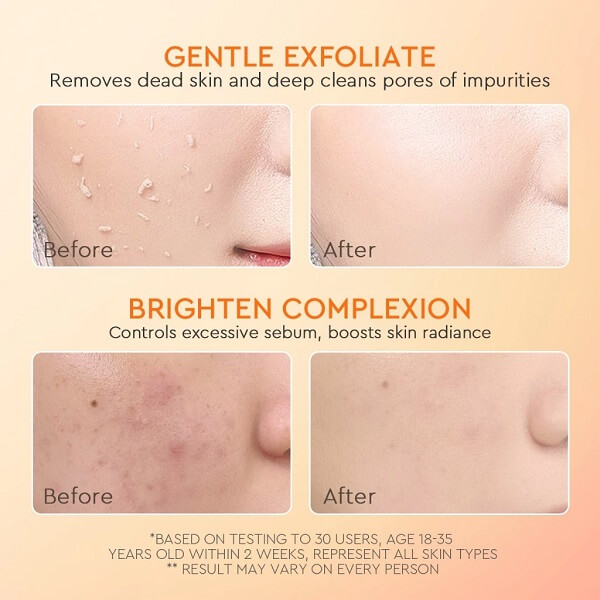 Glad2Glow Apricot Glycolic Acid Exfo Smooth Peeling Gel - Image 7