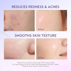 Glad2Glow Blueberry Ceramide Moisturizer