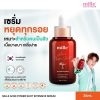 Mille Acne Power Shot Intensive Serum
