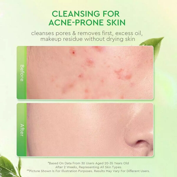 Glad2Glow Matcha Salicylic Acid Acne Cleanser - Image 4