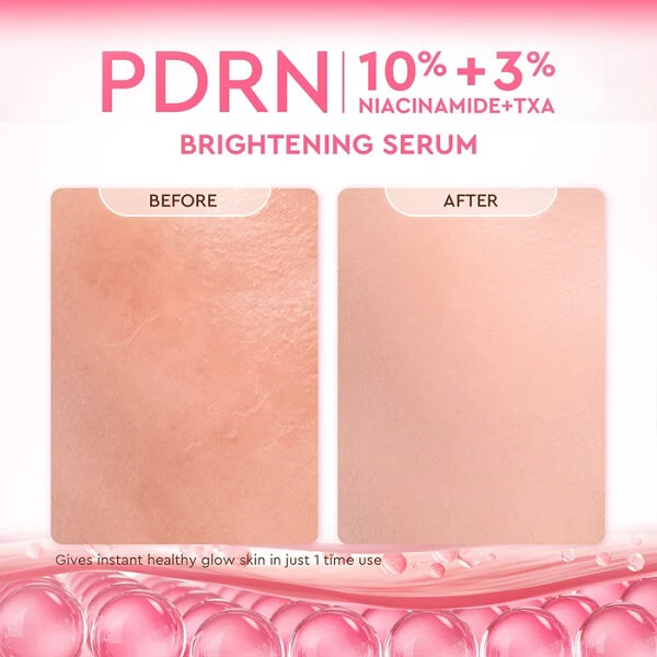 Glad2Glow PDRN 10% Niacinamide 3% TXA Brightening Serum - Image 10